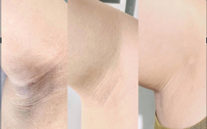 Crema blanqueadora de axilas RUCOS