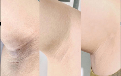 Crema blanqueadora de axilas RUCOS