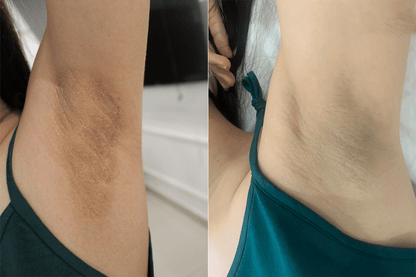 Crema blanqueadora de axilas RUCOS